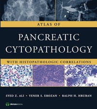 表紙画像: Atlas of Pancreatic Cytopathology 1st edition 9781933864402