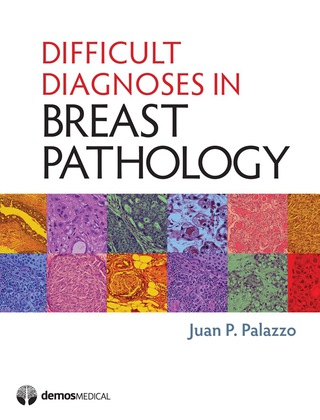 Cover image: Difficult Diagnoses in Breast Pathology 1st edition 9781933864792