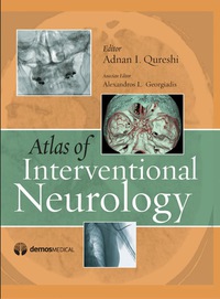 Cover image: Atlas of Interventional Neurology 1st edition 9781933864310