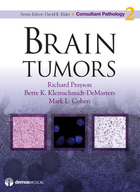 Cover image: Brain Tumors 1st edition 9781933864693