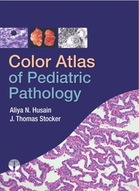 Omslagafbeelding: Color Atlas of Pediatric Pathology 1st edition 9781933864570