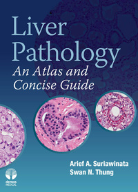Cover image: Liver Pathology 1st edition 9781933864945