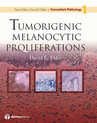 Immagine di copertina: Tumorigenic Melanocytic Proliferations 1st edition 9781933864648