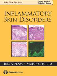 表紙画像: Inflammatory Skin Disorders 1st edition 9781933864877