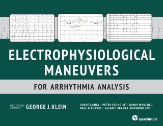 Cover image: Electrophysiological Maneuvers for Arrhythmia Analysis 1st edition 9781935395898