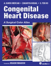 Cover image: Congenital Heart Disease: A Surgical Color Atlas 1st edition 9781935395904