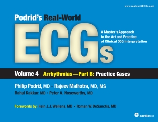Cover image: Podrid's Real-World ECGs: Volume 4B, Arrhythmias [Practice Cases] 1st edition