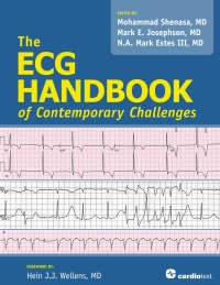 Omslagafbeelding: The ECG Handbook of Contemporary Challenges 1st edition 9781935395881