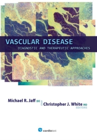 Cover image: Vascular Disease: Diagnostic and Therapeutic Approaches 1st edition 9781935395164