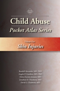 Titelbild: Child Abuse Pocket Atlas, Volume 1 1st edition 9781936590582