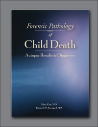 Omslagafbeelding: Forensic Pathology of Child Death 9781936590421