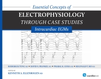 Titelbild: Essential Concepts of Electrophysiology through Case Studies: Intracardiac EGMs 1st edition 9781935395331