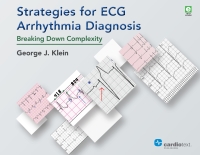 Cover image: Strategies for ECG Arrhythmia Diagnosis 1st edition 9781942909248