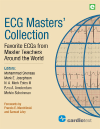 表紙画像: ECG Masters Collection 1st edition 9781942909088