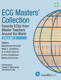 Immagine di copertina: ECG Masters Collection Volume 2 1st edition 9781942909200