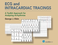 Cover image: ECG and Intracardiac Tracings 1st edition 9781942909255
