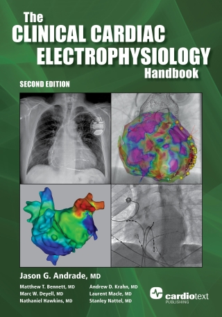 Cover image: Clinical Cardiac Electrophysiology Handbook, Second Edition 2nd edition 9781942909347