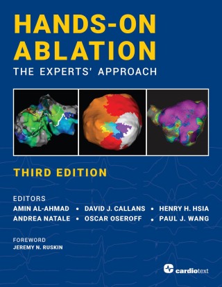 Cover image: Hands-On Ablation, The Experts' Approach, Third Edition 3rd edition 9781942909408