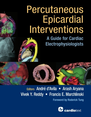 Cover image: Percutaneous Epicardial Interventions: 1st edition 9781942909316