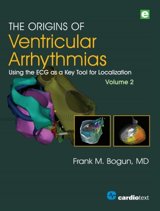 Cover image: The Origins of Ventricular Arrhythmias, Volume 2 1st edition 9781942909415