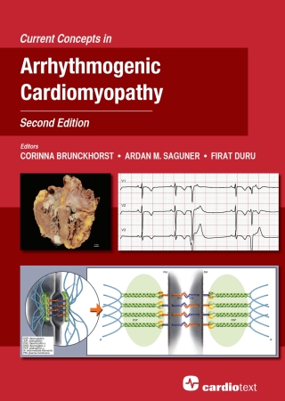 Cover image: Current Concepts in Arrhythmogenic Cardiomyopathy, Second Edition 2nd edition 9781942909507