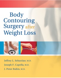 Imagen de portada: Body Contouring Surgery After Weight Loss 1st edition 9781886039186