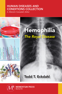 Imagen de portada: Hemophilia 9781944749637