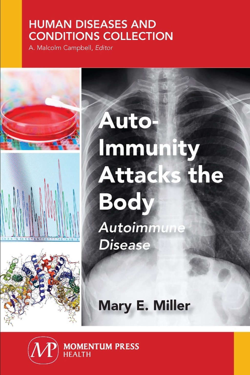 Auto-Immunity Attacks the Body Autoimmune Disease