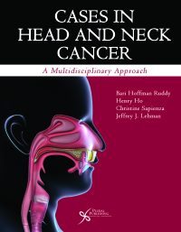 Cover image: Cases in Head and Neck Cancer: A Multidisciplinary Approach 1st edition 9781597567152