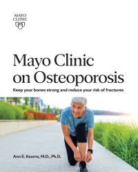 Cover image: Mayo Clinic on Osteoporosis 9781893005242