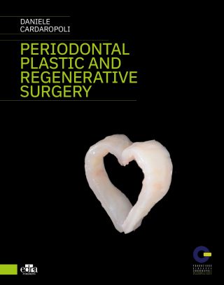Cover image: Peridontal plastic and regenerative surgery 1st edition 9781957260075