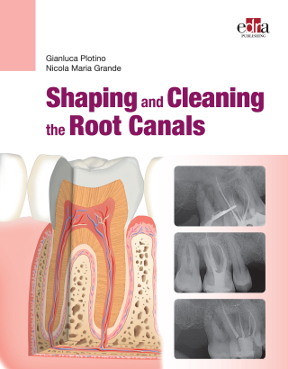 Cover image: Shaping and  Cleaning the Root Canals 1st edition 9781957260242