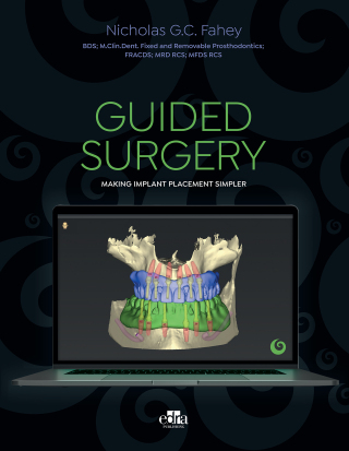 Cover image: Guided surgery - Making implant placement simpler 1st edition 9781737126171