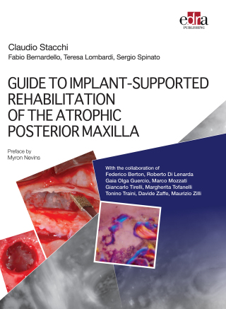 Cover image: GUIDE TO IMPLANT-SUPPORTED REHABILITATION OF THE ATROPHIC POSTERIOR MAXILLA 1st edition 9781962679312