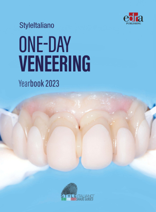 Cover image: ONE-DAY VENEERING - StyleItaliano Yearbook 2023 1st edition 9781962679992