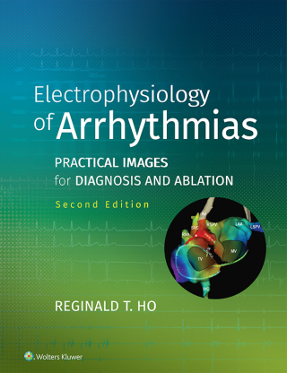 Cover image: Electrophysiology of Arrhythmias 2nd edition 9781975101107