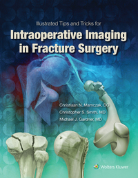 Cover image: Illustrated Tips and Tricks for Intraoperative Imaging in Fracture Surgery 9781496328960
