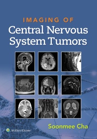 صورة الغلاف: Imaging of Central Nervous System Tumors 1st edition 9781975103743