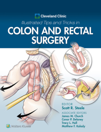 Cover image: Cleveland Clinic Illustrated Tips and Tricks in Colon and Rectal Surgery 9781975108250