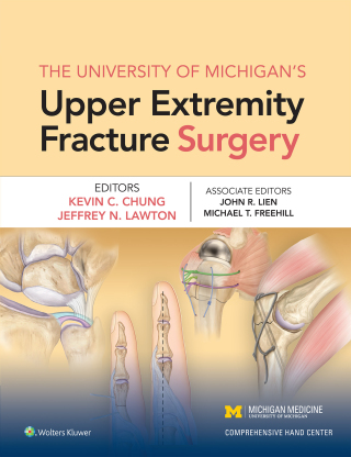 صورة الغلاف: The University of Michigan's Upper Extremity Fracture Surgery 9781975110437
