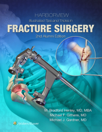Omslagafbeelding: Harborview Illustrated Tips and Tricks in Fracture Surgery 2nd edition 9781496355980