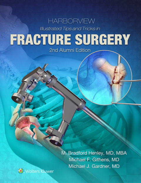 Harborview Illustrated Tips and Tricks in Fracture Surgery, 2nd Edition - FULL INSTANT DOWNLOAD | PDF DOCX EPUB