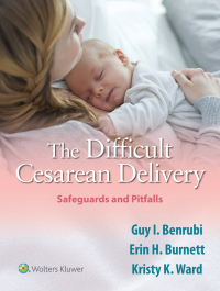 Cover image: The Difficult Cesarean Delivery: Safeguards and Pitfalls 9781975116675