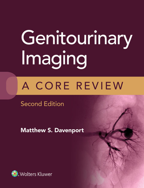 Genitourinary Imaging: A Core Review, 2nd Edition - FULL INSTANT DOWNLOAD | PDF DOCX EPUB