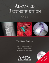 表紙画像: Advanced Reconstruction: Knee 9781975121747