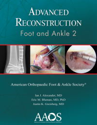 Omslagafbeelding: Advanced Reconstruction: Foot and Ankle 2 9781975122676