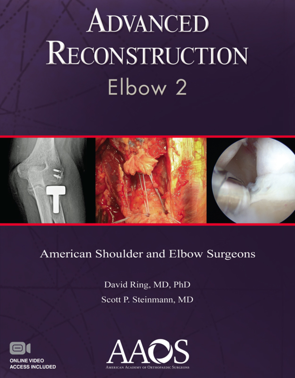 Advanced Reconstruction Elbow 2 eBook