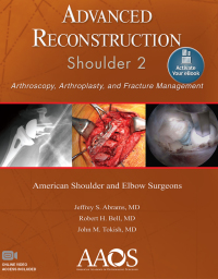 Cover image: Advanced Reconstruction: Shoulder 2 9781975123475