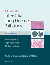 Cover image: Atlas of Interstitial Lung Disease Pathology 2nd edition 9781975124670
