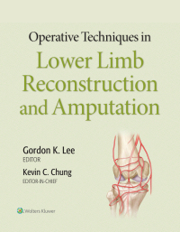 Cover image: Operative Techniques in Lower Limb Reconstruction and Amputation 9781975127343